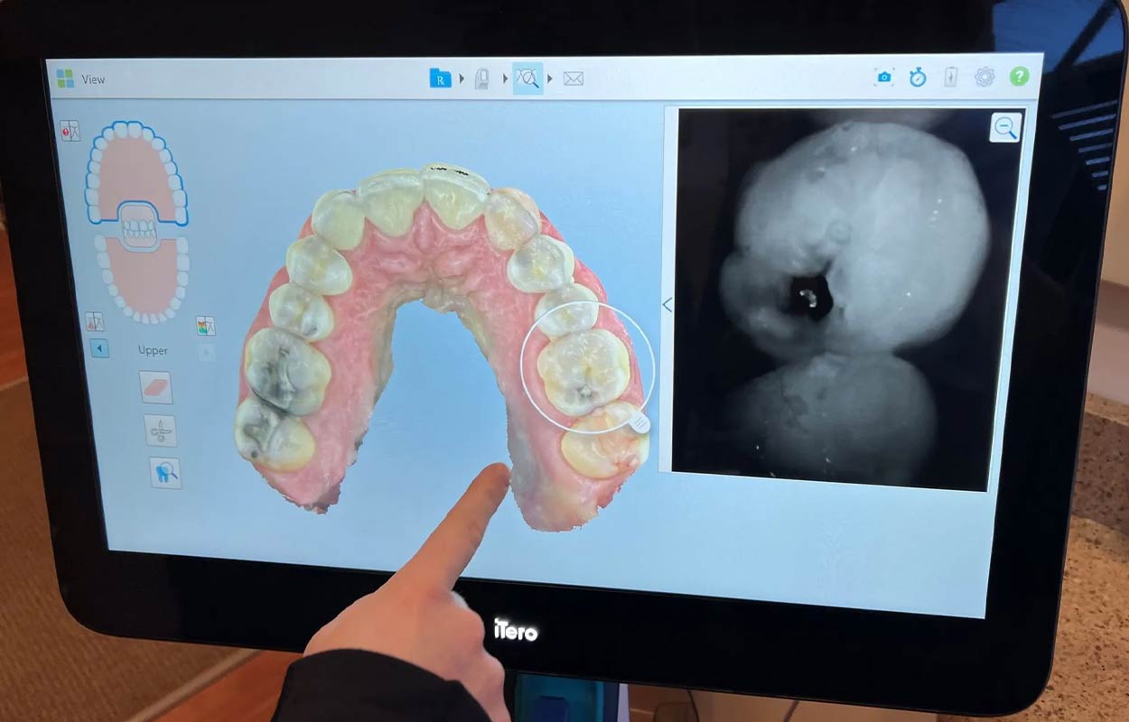 Dental Fillings Alcan Family Dental, Same Day Dental Crown Anchorage AK, Family Dental Clinic Anchorage AK, Emergency Dental Care Anchorage AK, Emergency Dental Services Anchorage AK, Dentist Office Anchorage AK, Anchorage Dentures Medicaid, Emergency Dentures Anchorage