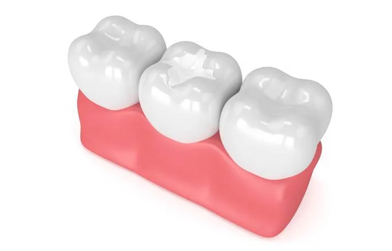 Alcan Family Dental, Same Day Dental Crown Anchorage AK, Family Dental Clinic Anchorage AK, Emergency Dental Care Anchorage AK, Emergency Dental Services Anchorage AK, Dentist Office Anchorage AK, Anchorage Dentures Medicaid, Emergency Dentures Anchorage