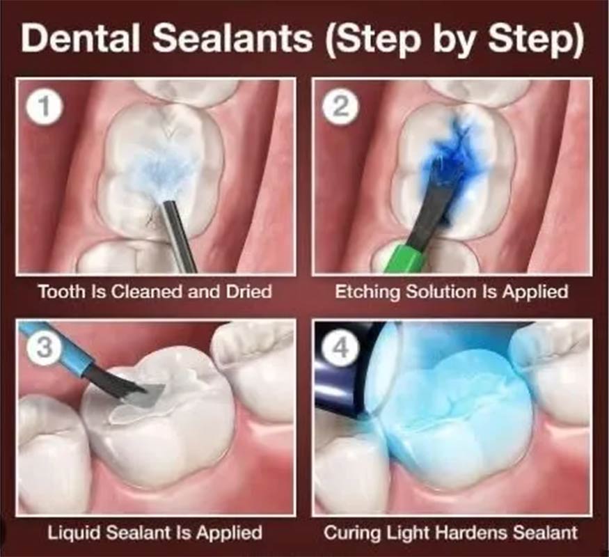 Alcan Family Dental, Same Day Dental Crown Anchorage AK, Family Dental Clinic Anchorage AK, Emergency Dental Care Anchorage AK, Emergency Dental Services Anchorage AK, Dentist Office Anchorage AK, Anchorage Dentures Medicaid, Emergency Dentures Anchorage
